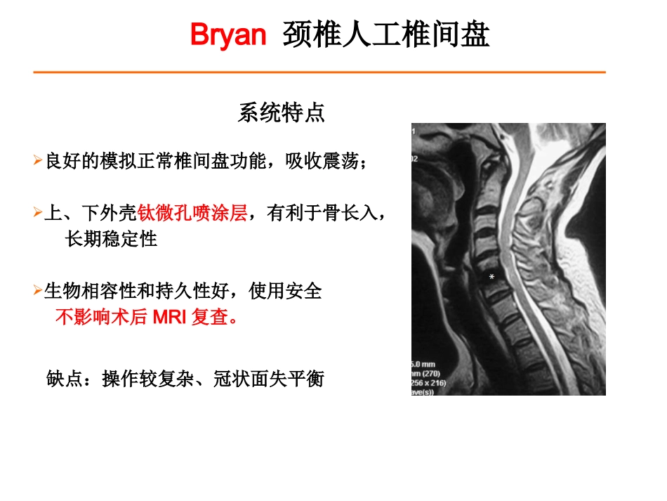 颈椎人工椎间盘CDR_第8页