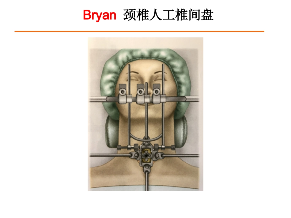 颈椎人工椎间盘CDR_第9页