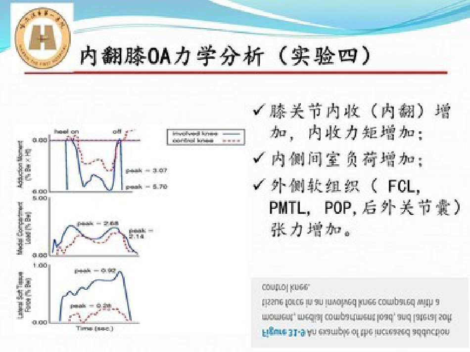 胫骨高位截骨治疗膝关节骨性关节炎_第13页
