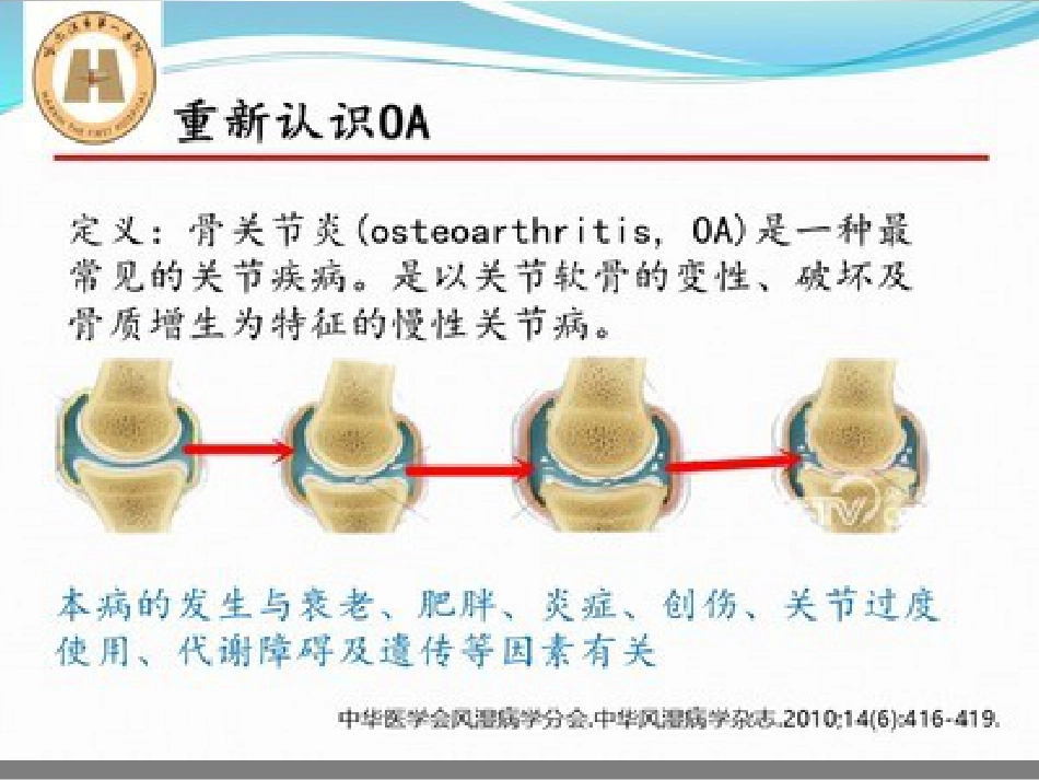 胫骨高位截骨治疗膝关节骨性关节炎_第3页