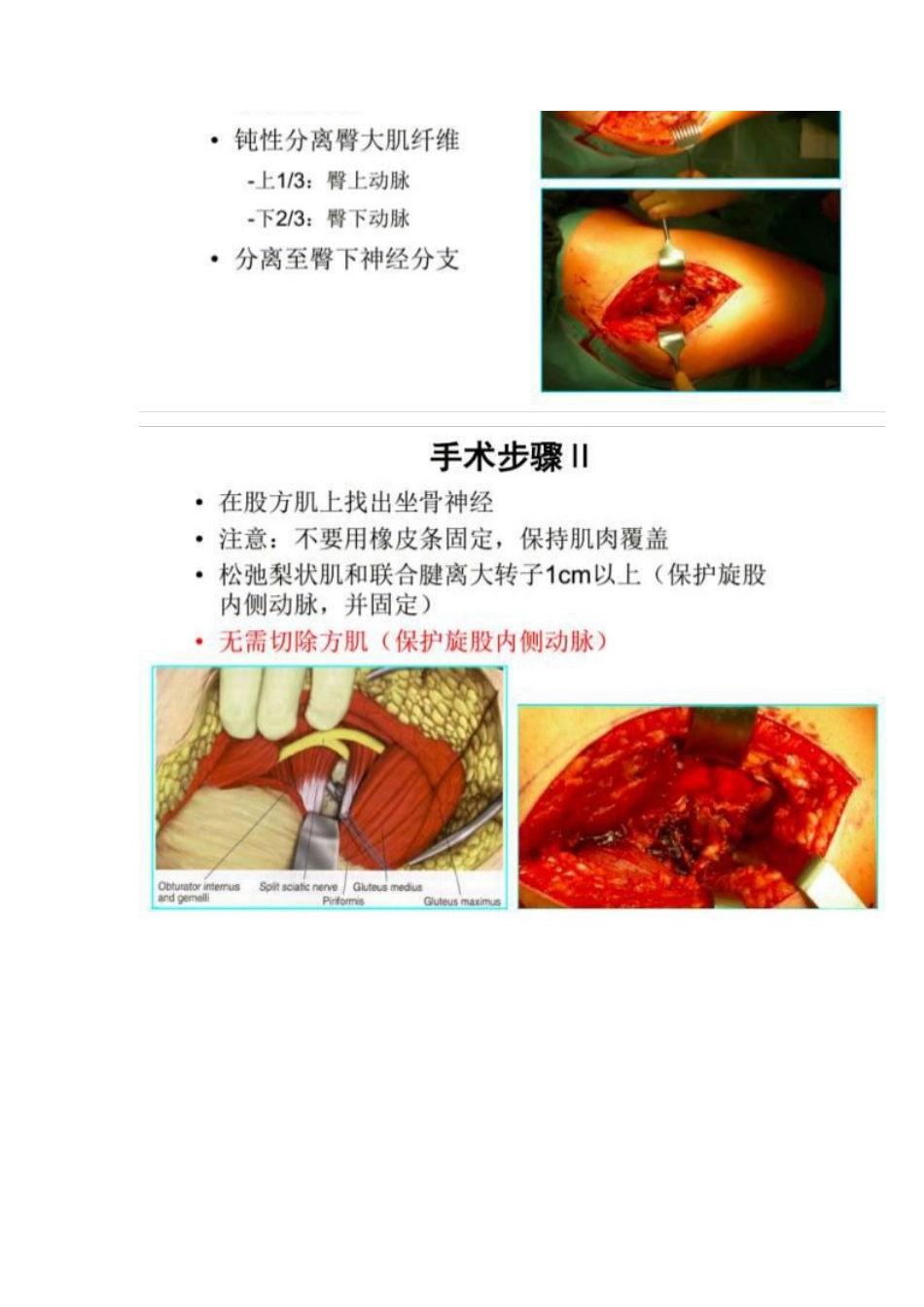 髋部骨折的手术入路及步骤_第11页