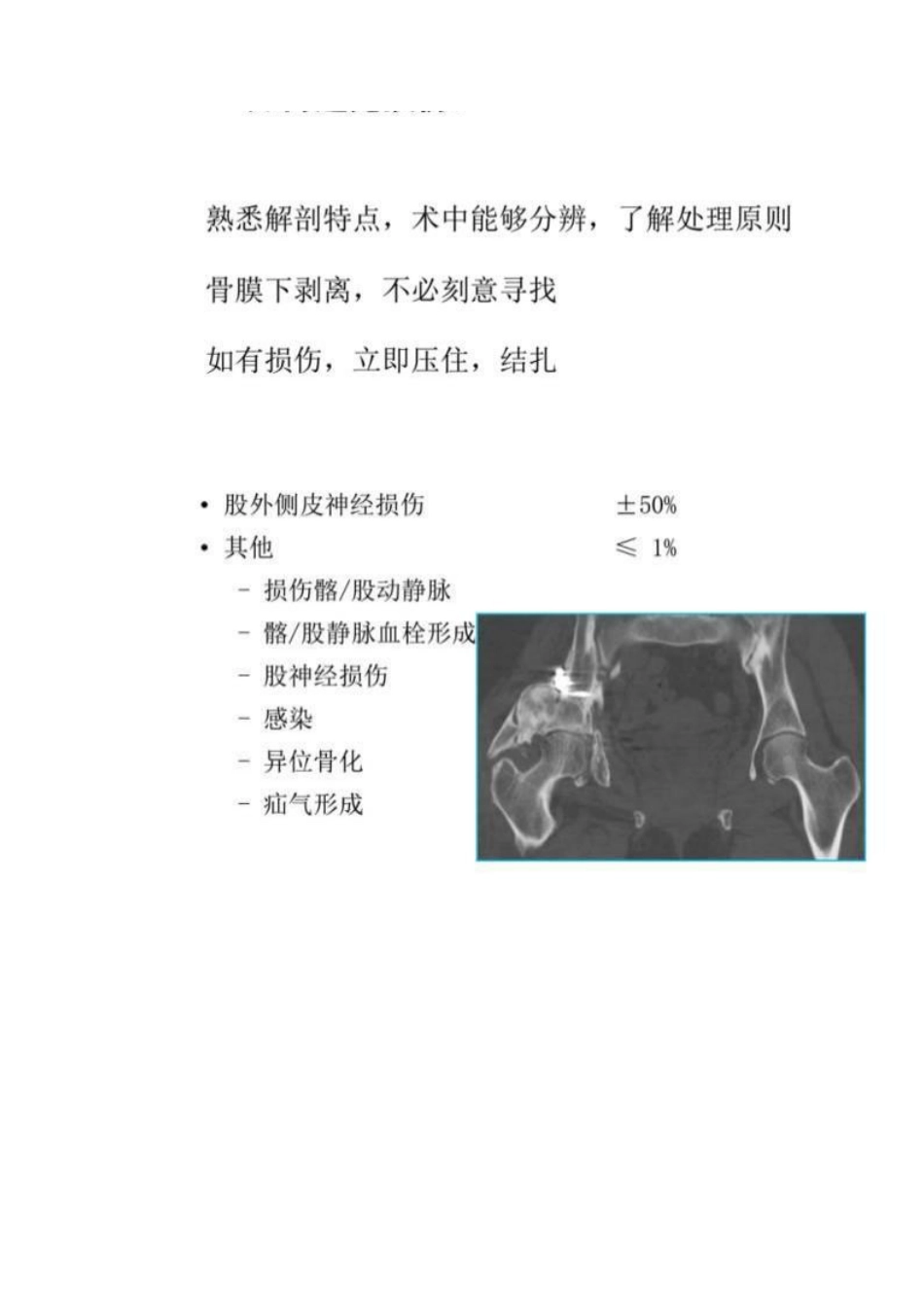 髋部骨折的手术入路及步骤_第8页