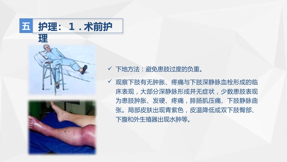 人工髋关节置换术后预防下肢深静脉血栓形成的护理_第13页