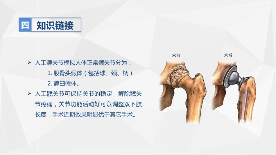 人工髋关节置换术后预防下肢深静脉血栓形成的护理_第8页