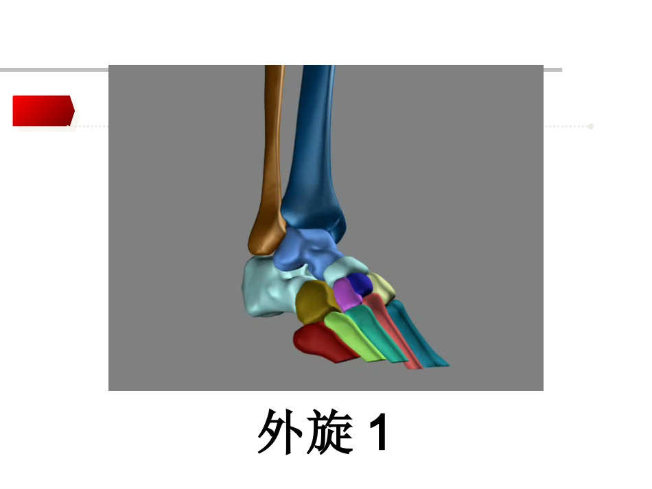 踝关节骨折Lauge-hansen分型的理解与评价_第14页