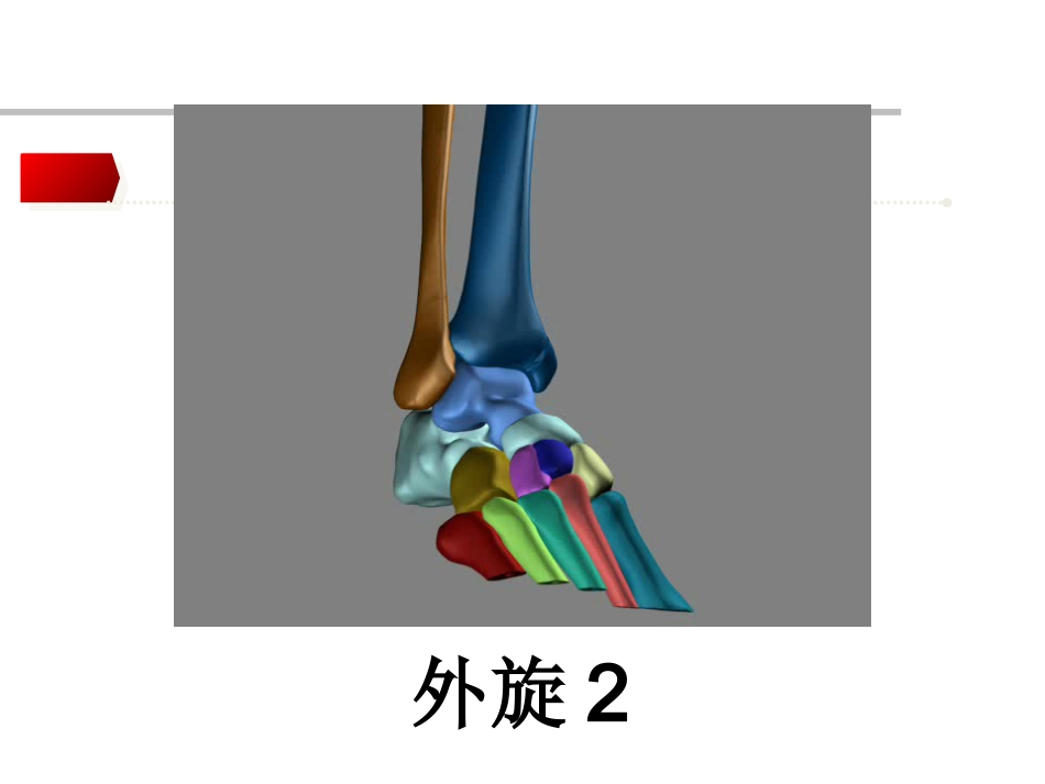 踝关节骨折Lauge-hansen分型的理解与评价_第15页