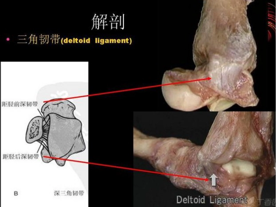 踝关节骨折Lauge-hansen分型的理解与评价_第3页