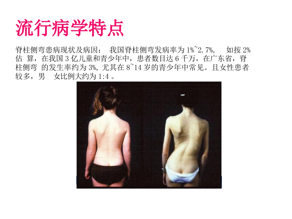脊柱侧弯的诊断及治疗一_第3页