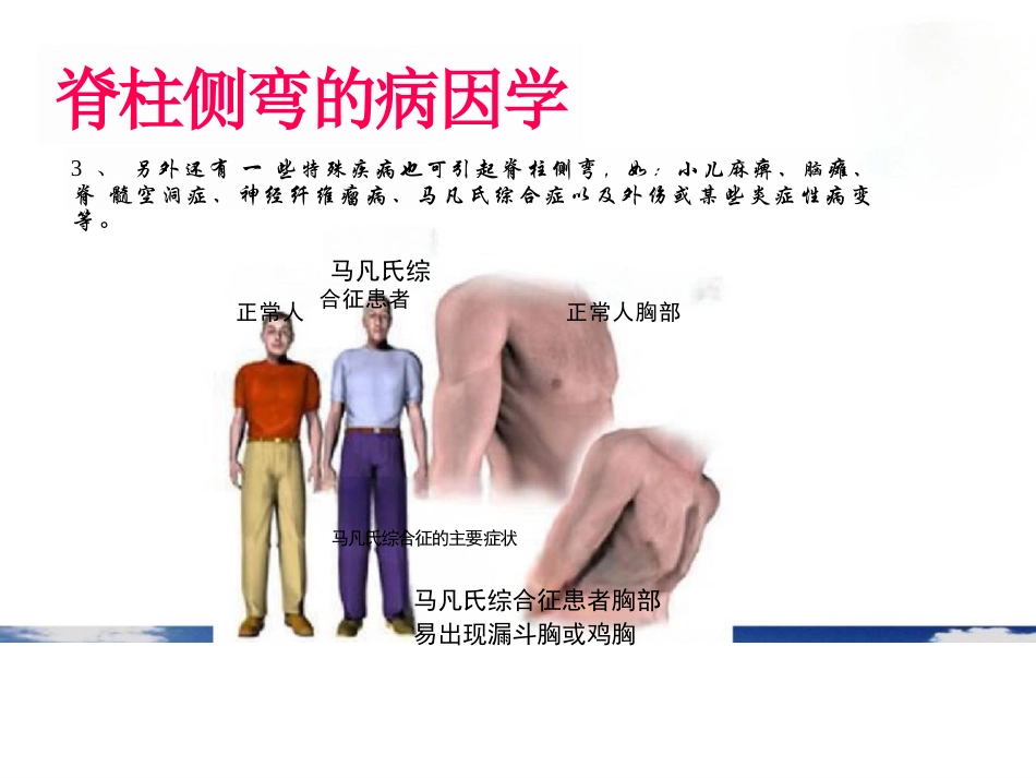 脊柱侧弯的诊断及治疗一_第6页