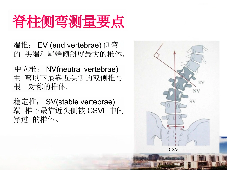 脊柱侧弯的诊断及治疗一_第8页