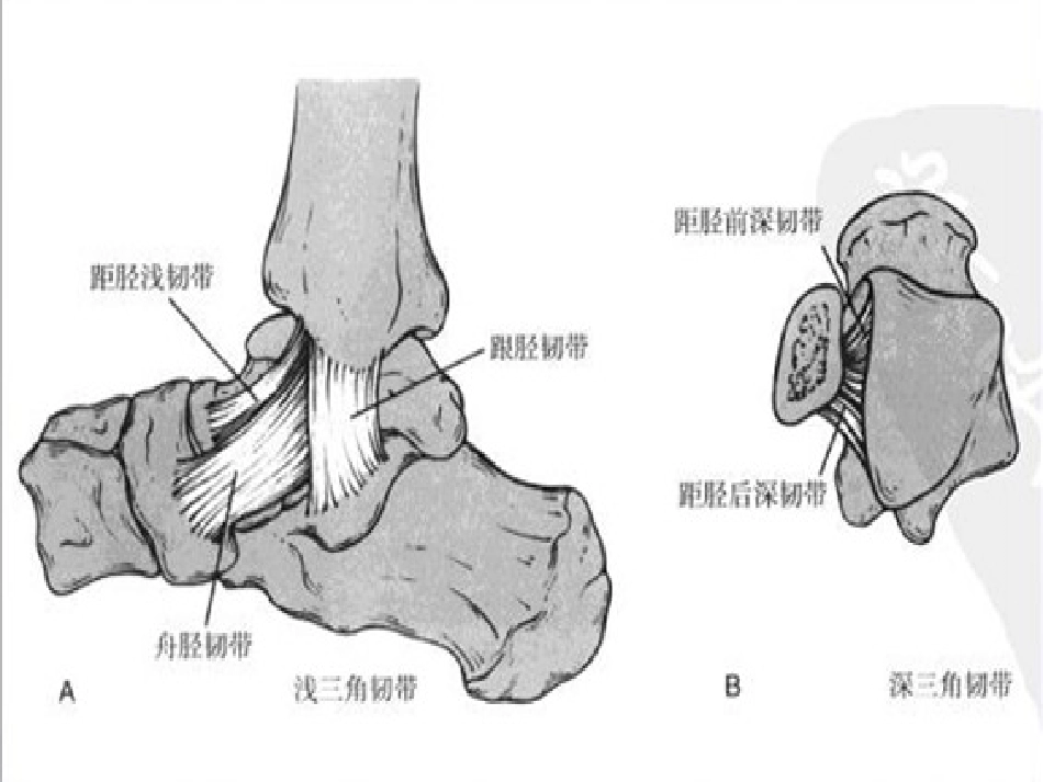 踝关节骨折——三踝骨折_第10页