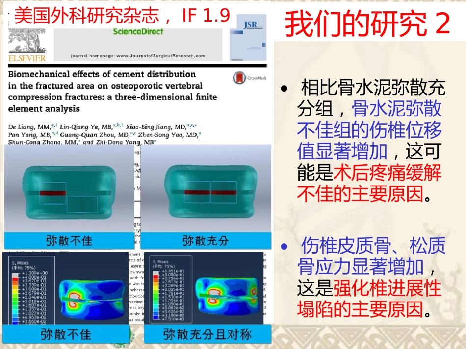 精准椎体成形术_第14页