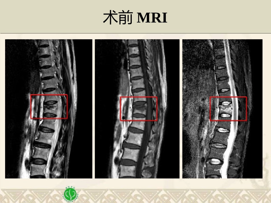 精准椎体成形术_第7页