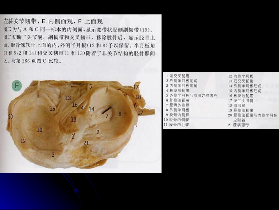 膝关节解剖及MRI诊断_第10页