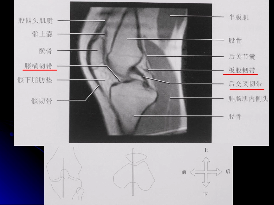 膝关节解剖及MRI诊断_第15页
