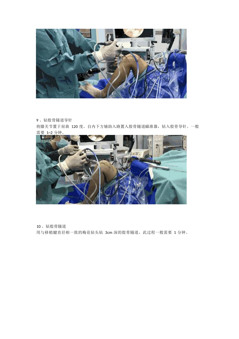 前交叉韧带（ACL）重建手术_第5页
