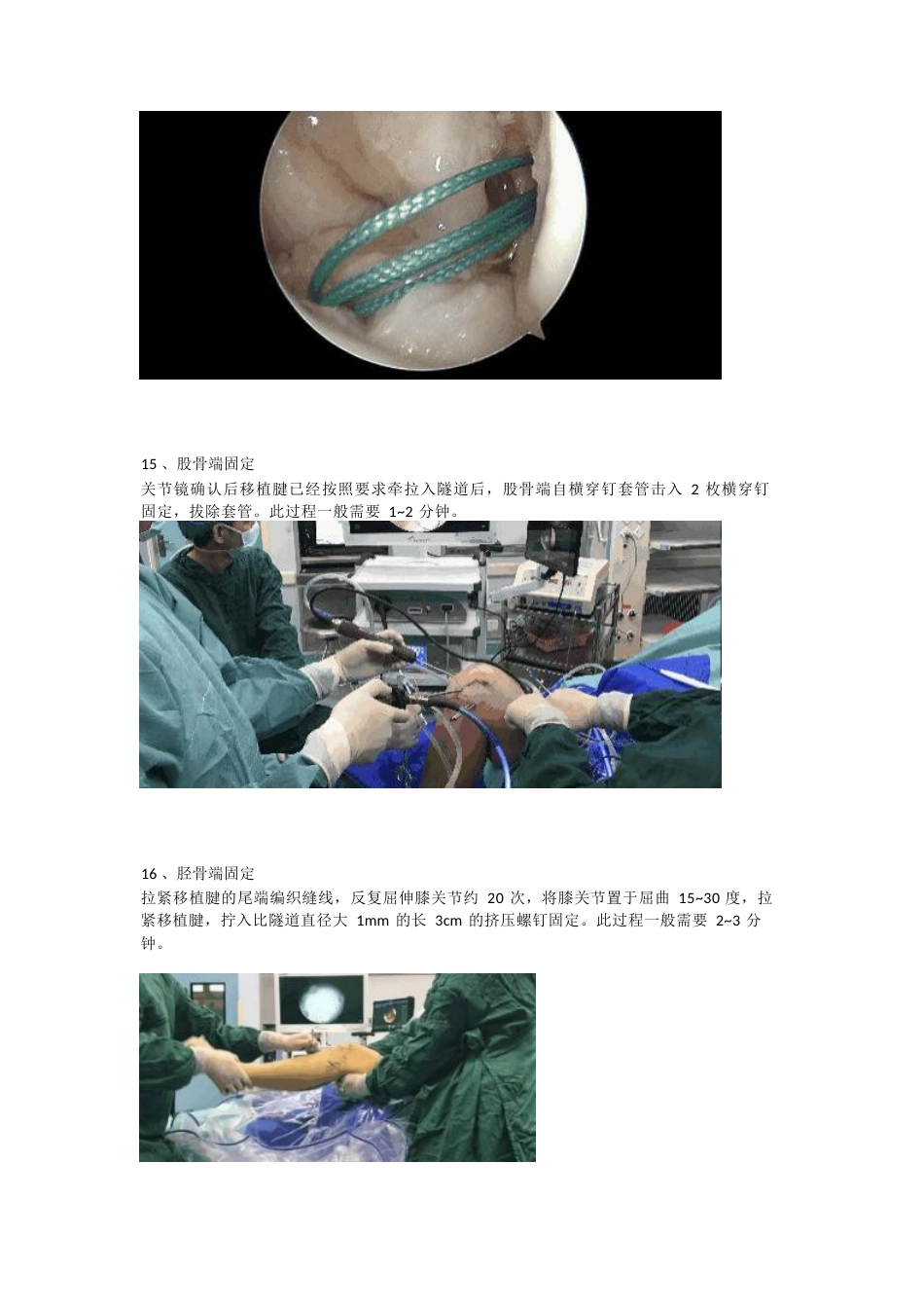 前交叉韧带（ACL）重建手术_第8页