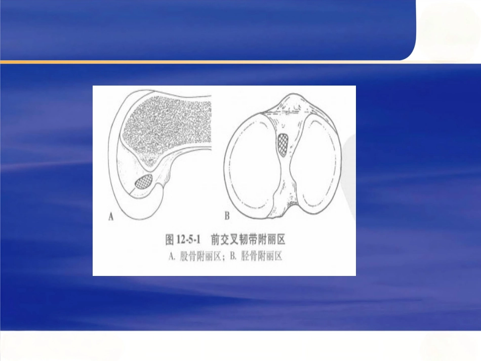 膝关节不稳的临床分型_第13页