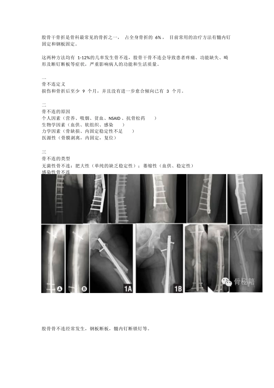 股骨干骨不连的双钢板治疗_第1页