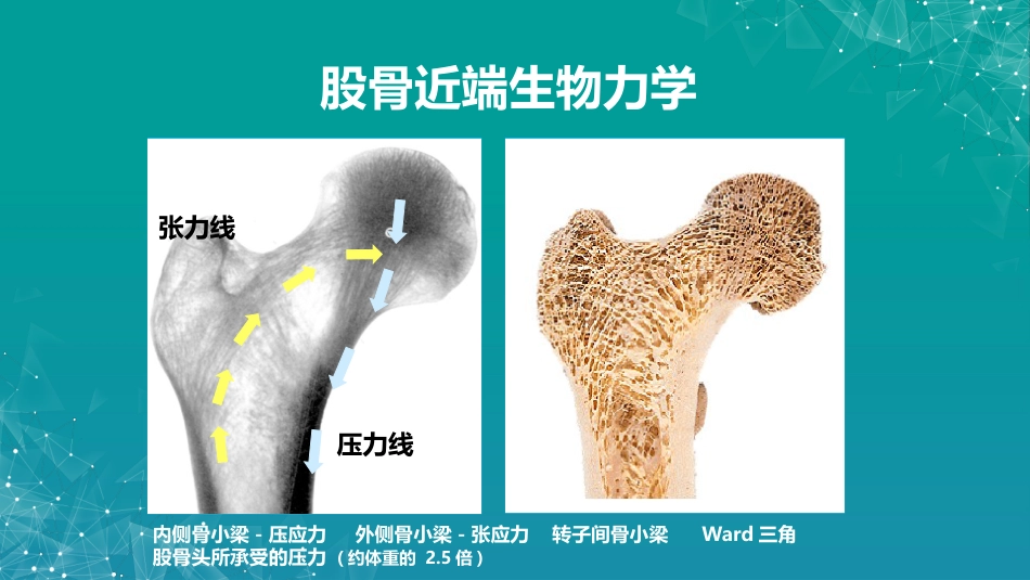 股骨粗隆间骨折若干问题的探讨_第10页