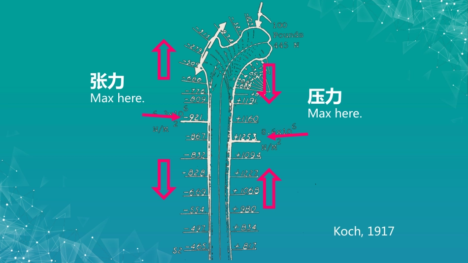 股骨粗隆间骨折若干问题的探讨_第11页