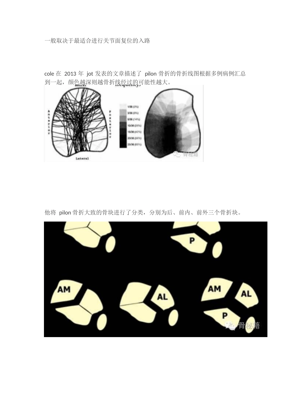 Pilon骨折的手术入路和手术技巧_第3页