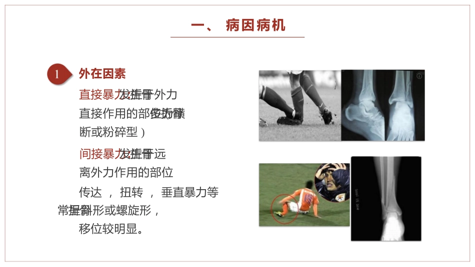 中医骨伤科学骨折概论临床知识学习课件PPT_第3页