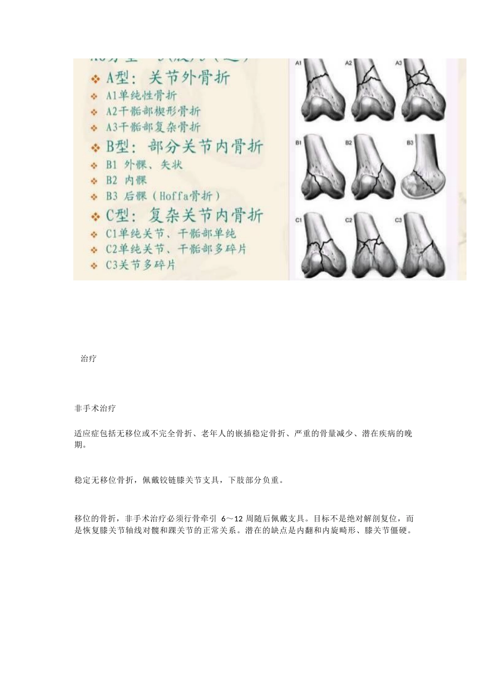 股骨远端骨折---固定方式决定手术成败!_第8页