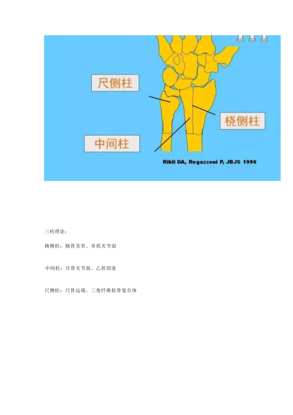 桡骨远端骨折的治疗策略_第5页