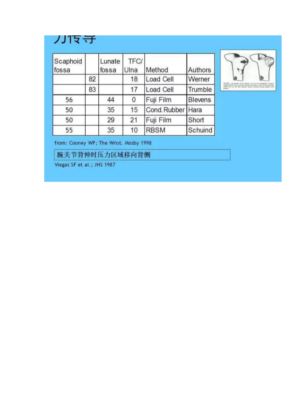 桡骨远端骨折的治疗策略_第7页