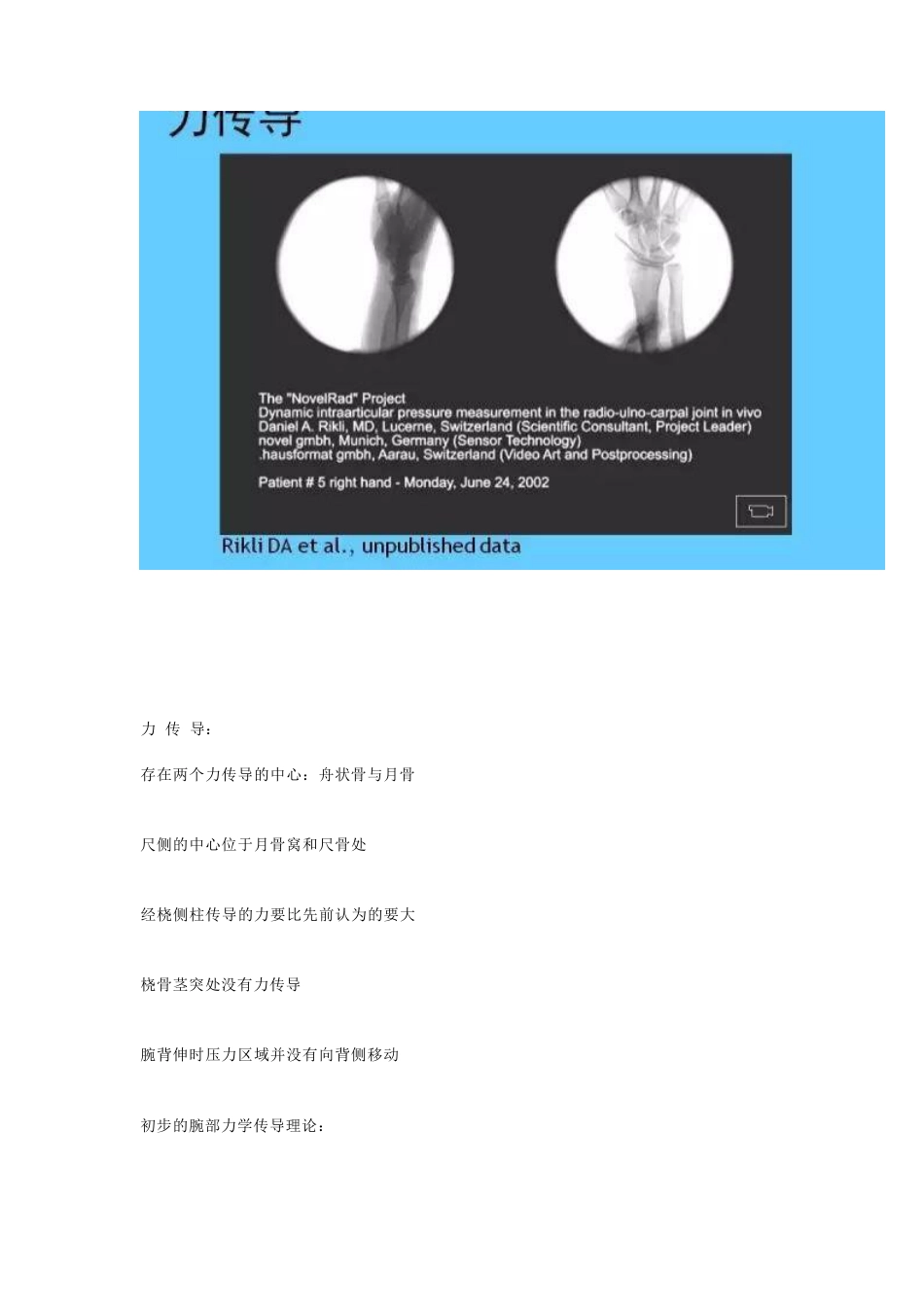 桡骨远端骨折的治疗策略_第8页