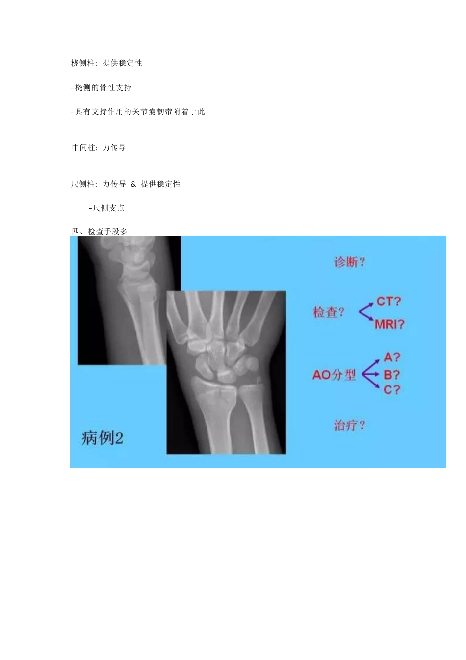 桡骨远端骨折的治疗策略_第9页