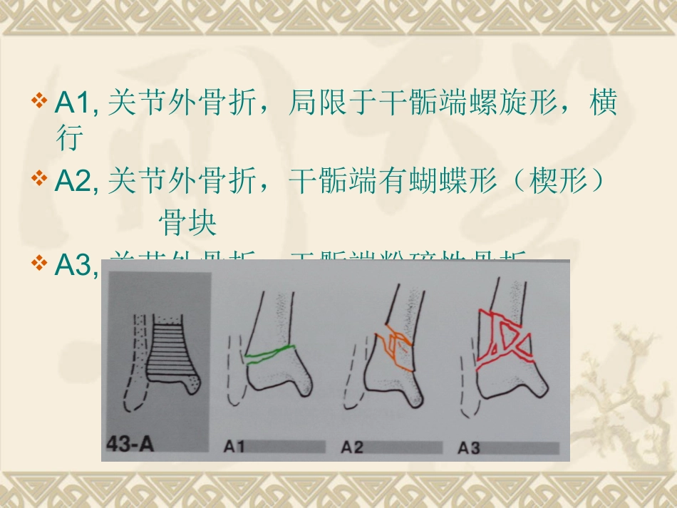 复杂性关节内骨折——pilon骨折治疗_第11页