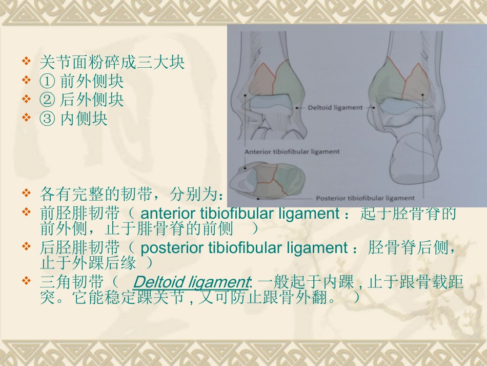 复杂性关节内骨折——pilon骨折治疗_第4页