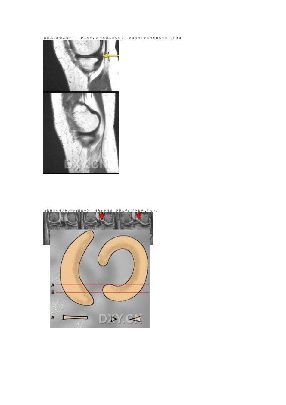 膝关节MRI诊断之正常解剖_第8页