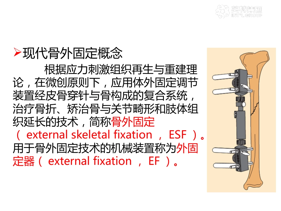 外固定架_第1页