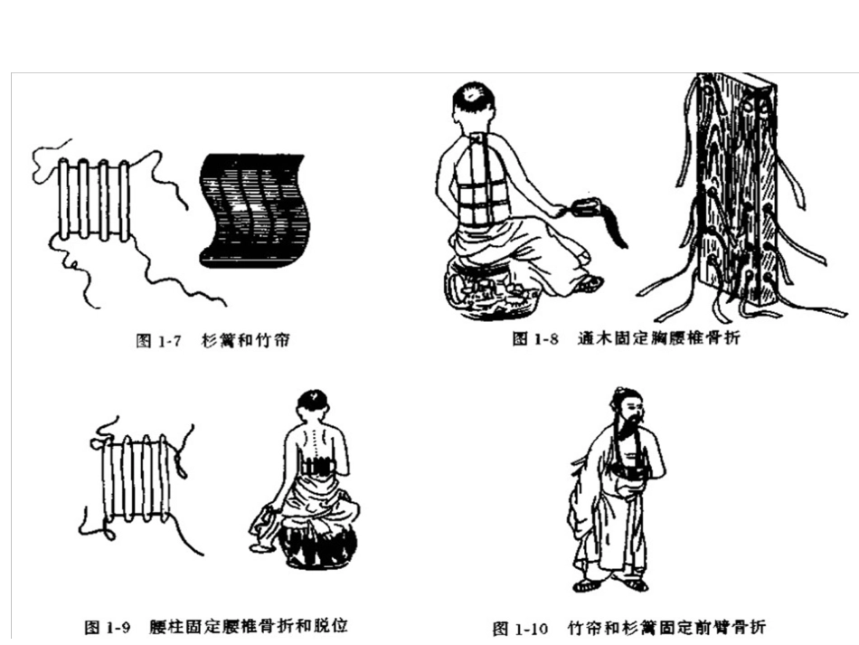 外固定架_第10页