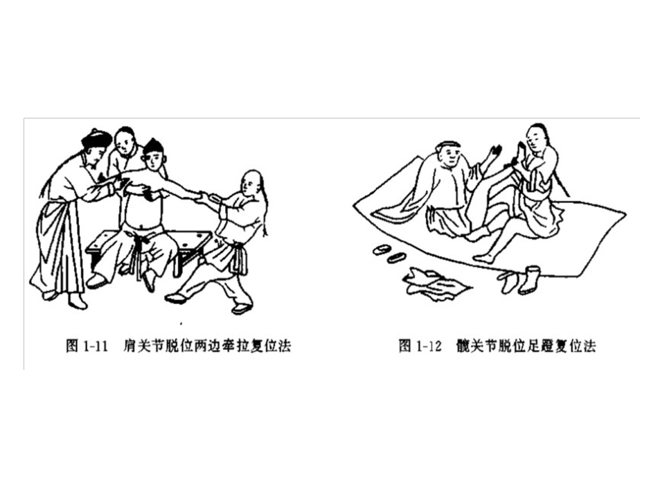 外固定架_第11页