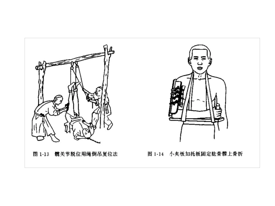 外固定架_第12页