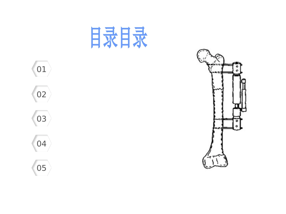 外固定架_第2页