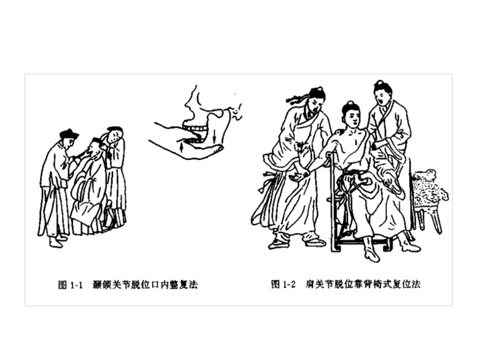 外固定架_第8页