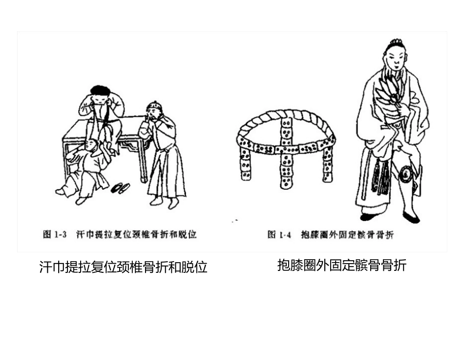 外固定架_第9页