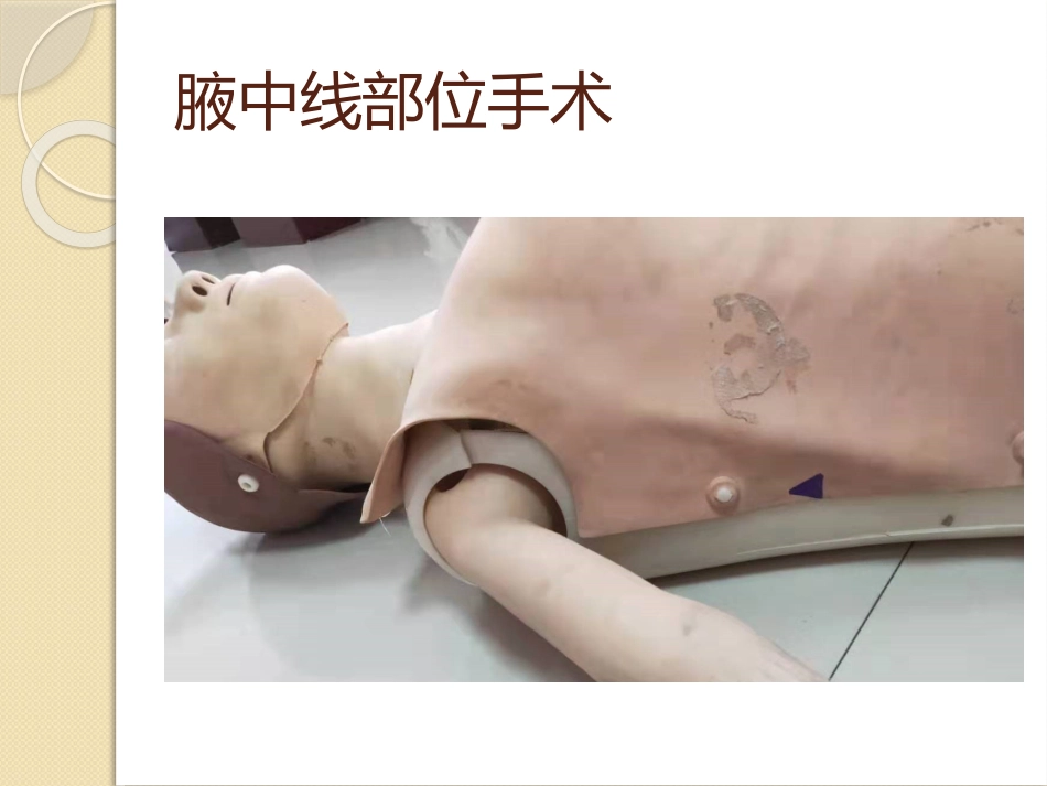 手术部位标记制度_第15页