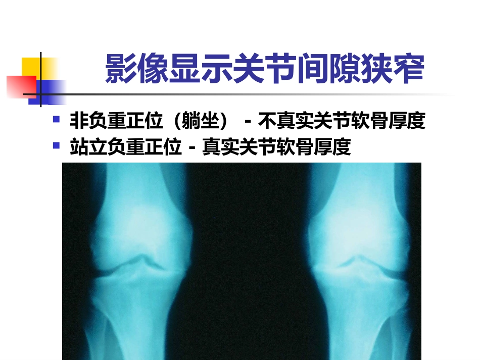全膝关节置换术二_第12页