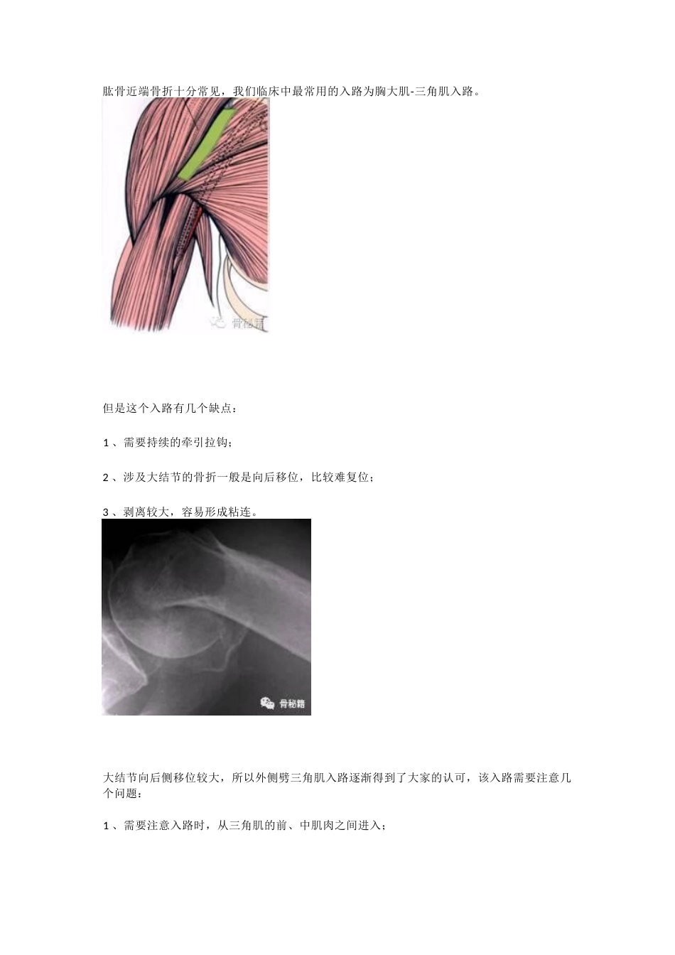 肱骨近端骨折的显露和复位技术_第1页