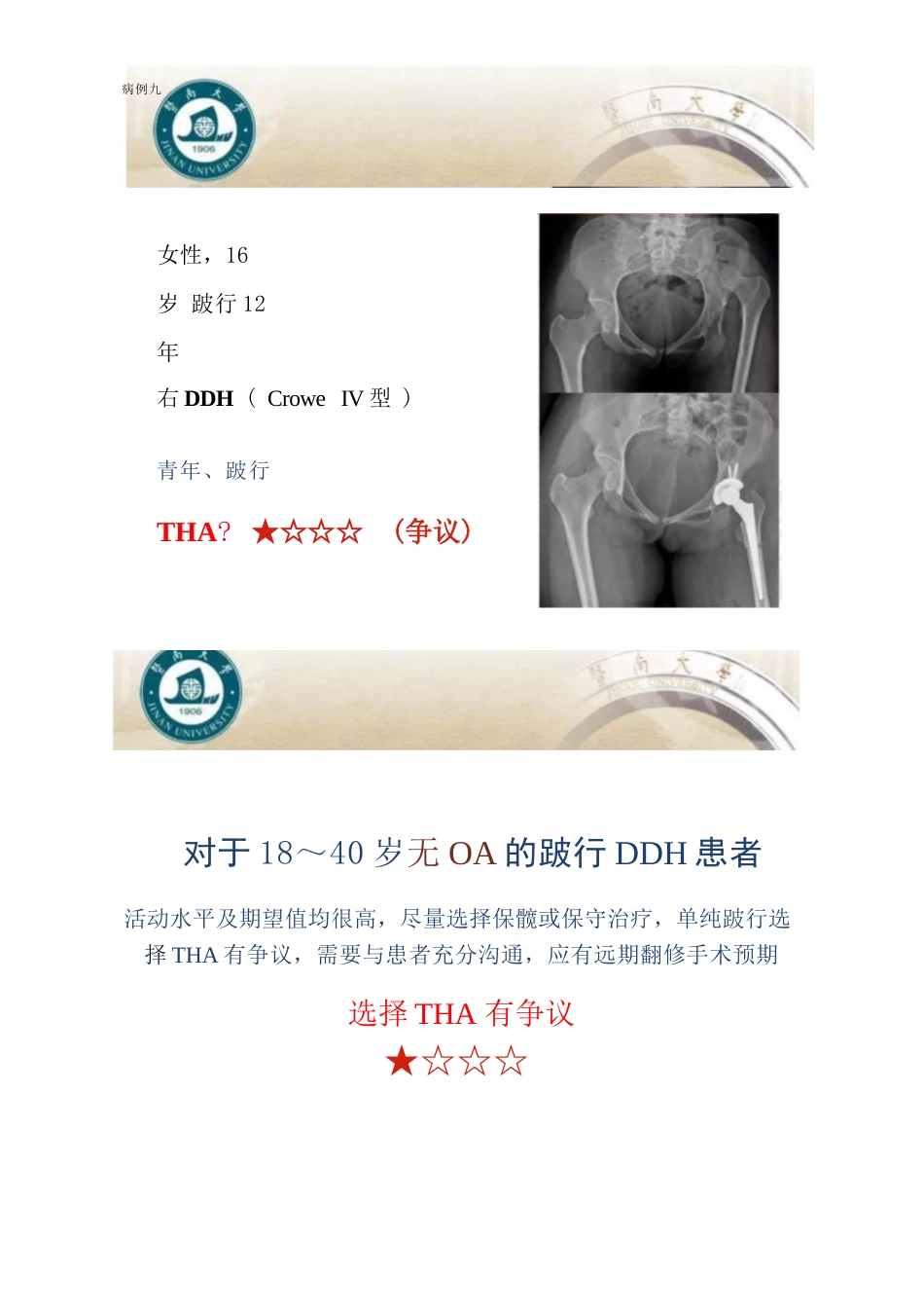 DDH全髋关节置换术的适应症及禁忌症_第10页