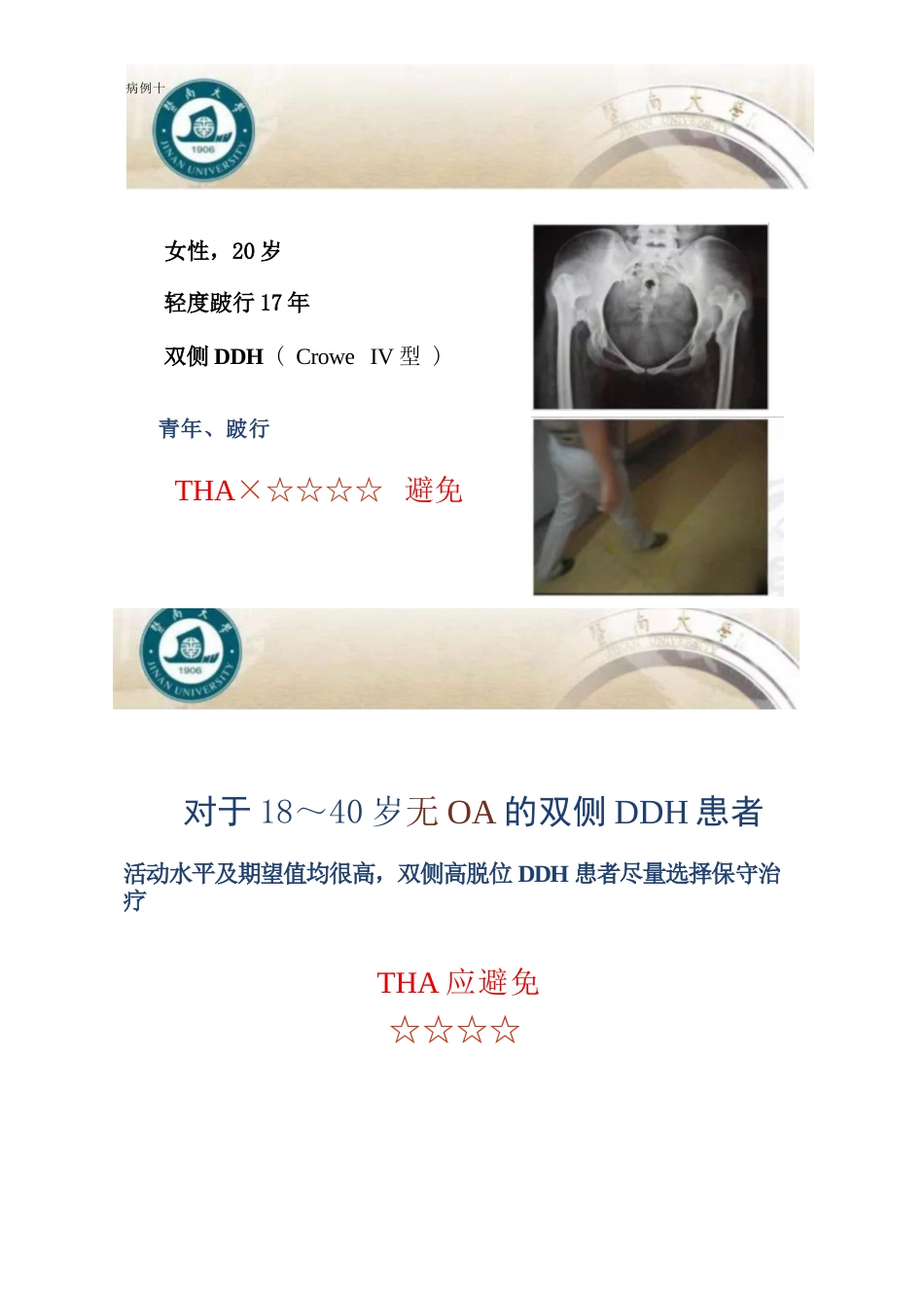 DDH全髋关节置换术的适应症及禁忌症_第11页