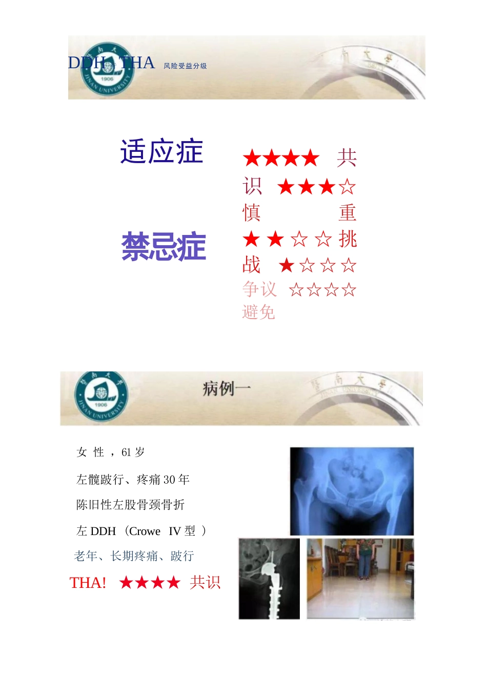 DDH全髋关节置换术的适应症及禁忌症_第3页
