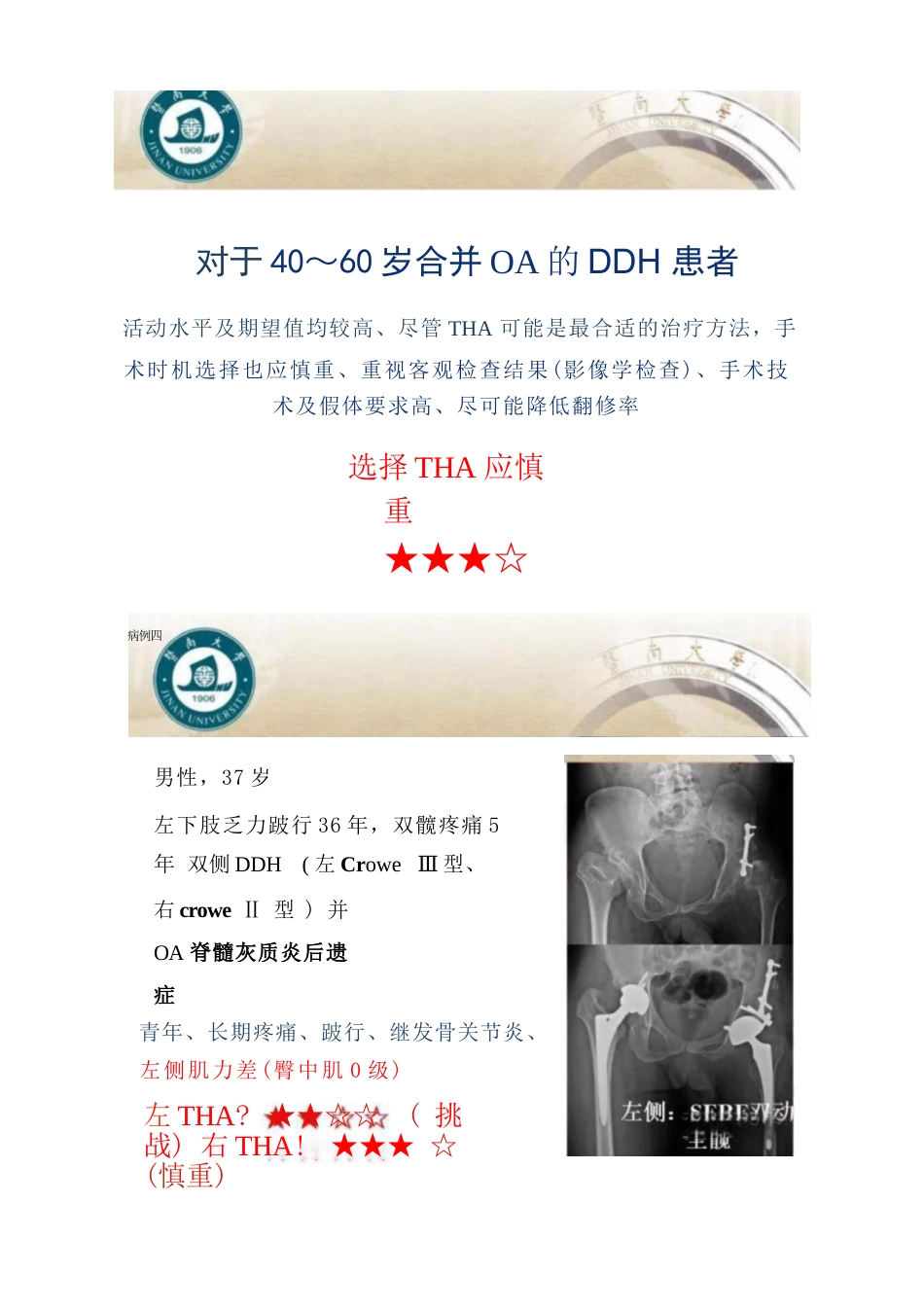 DDH全髋关节置换术的适应症及禁忌症_第6页