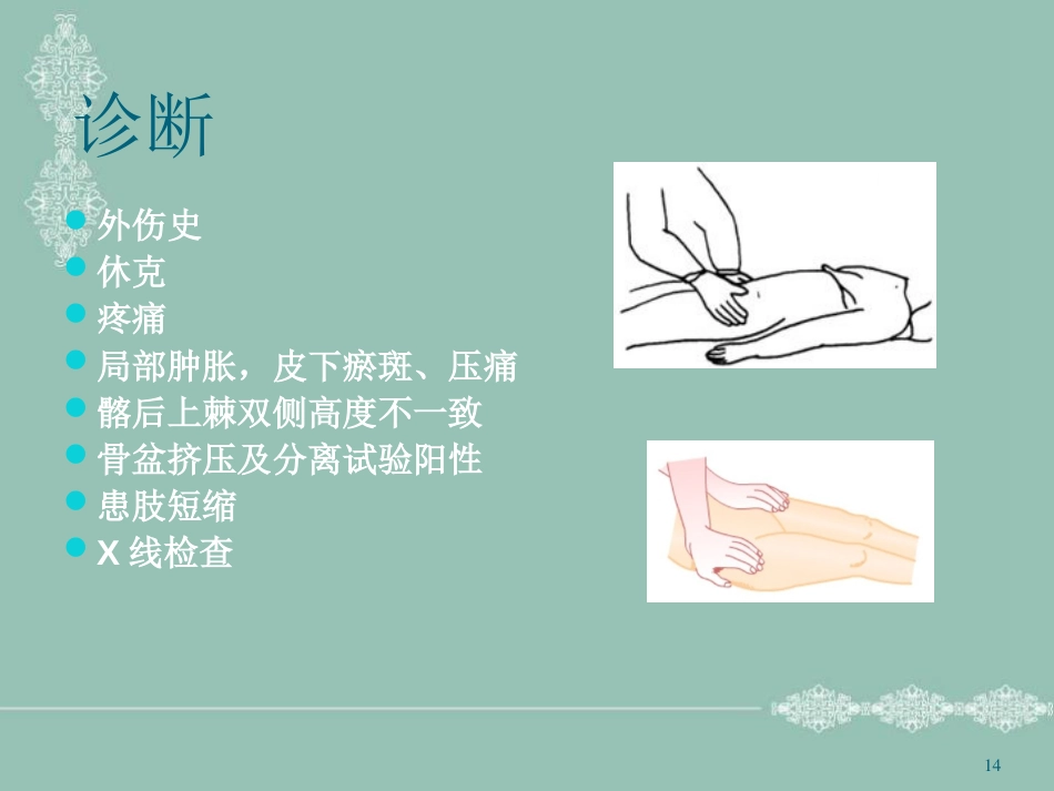 骨盆骨折护理PPT幻灯片_第14页